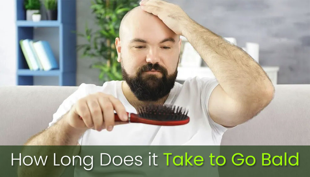 How long does it take to go bald-go-bald